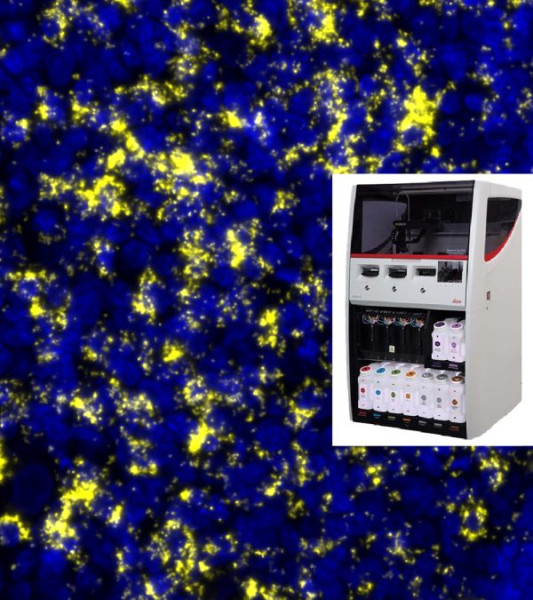Naveni PD1/PDL1 BOND RX RED