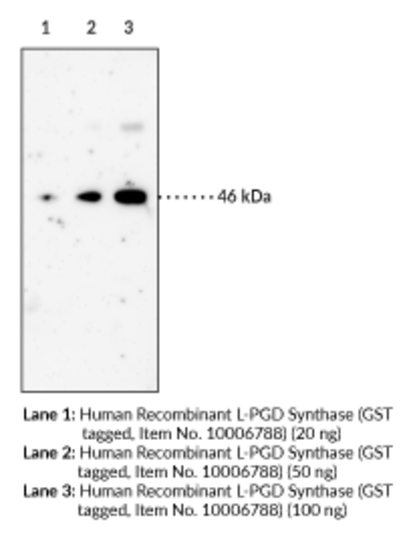 Anti-Prostaglandin D Synthase (lipocalin-type, human) (Clone 10A5)