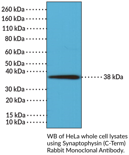 Anti-Synaptophysin (C-Term) Rabbit Monoclonal Antibody (Clone RM258)