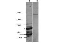 Anti-HDAC2