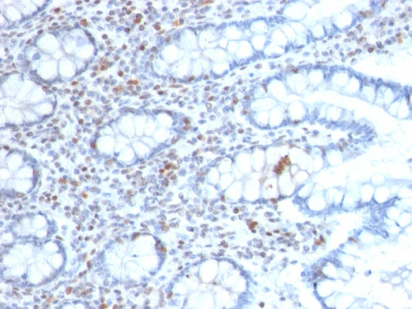 Anti-BMI1 (Oncogene and Stem Cell Marker), clone BMI1/2689