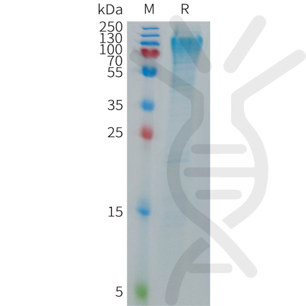 Human MANSC1 Protein, His Tag