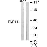 Anti-TNFSF11