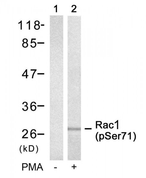 Anti-phospho-Rac1 (Ser71)