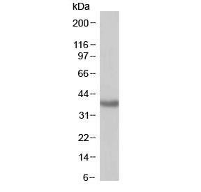 Anti-SIRT4