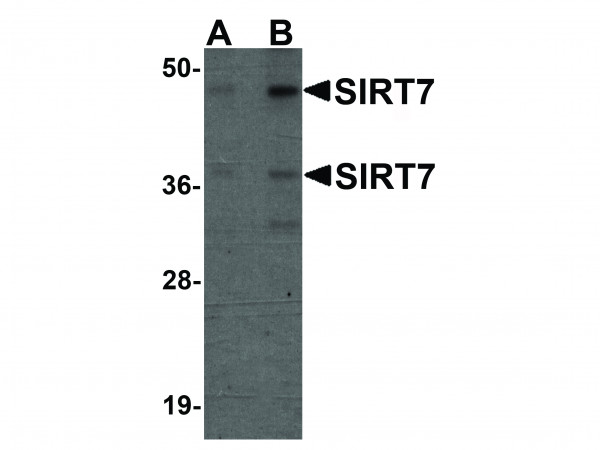 Anti-SIRT7