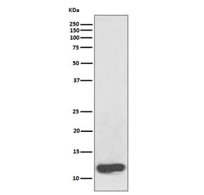Anti-Serum Amyloid A / SAA1 + SAA2, clone ABAE-19