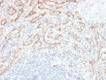 Anti-TNFS15 / VEGI (Vascular Endothelial Growth Inhibitor) Recombinant Rabbit Monoclonal Antibody (c
