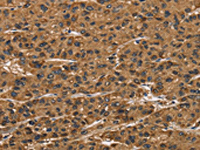 Anti-ATP7A