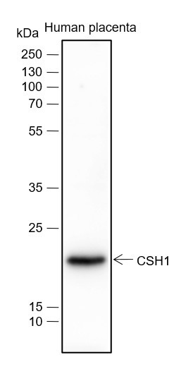 Anti-Recombinant Placental Lactogen, clone A259