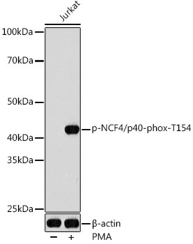 Anti-phospho-NCF4 (Thr154)