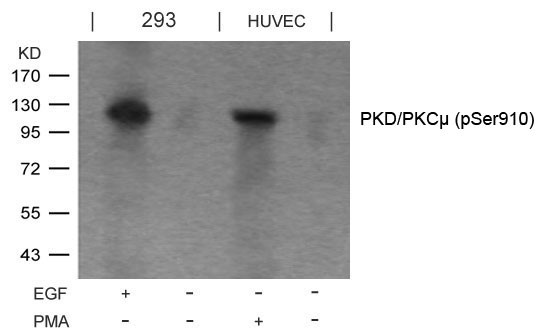 Anti-phospho-PKD/PKC mu (Ser910)