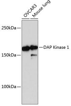 Anti-DAP Kinase 1 (DAPK1)