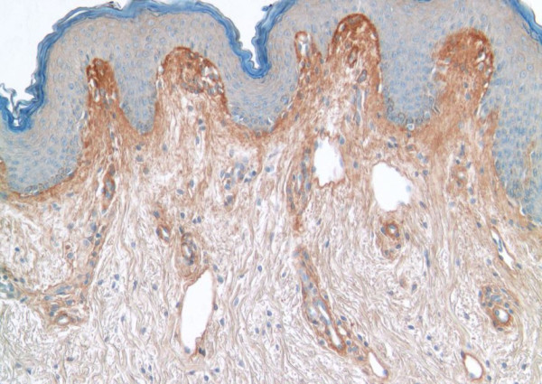 Anti-Collagen V