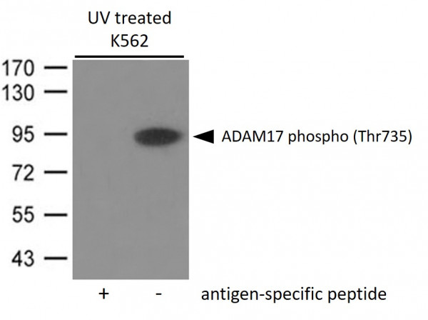 Anti-phospho-ADAM17 / TACE (Thr735)