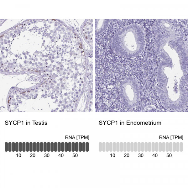 Anti-SYCP1