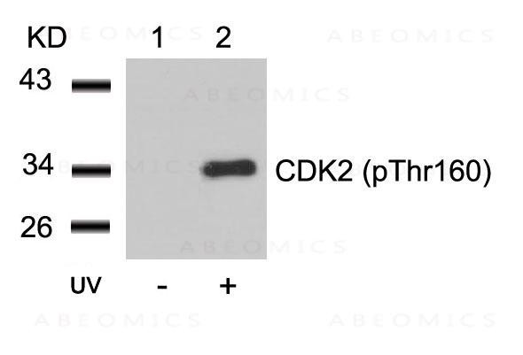 Anti-phospho-CDK2 (Thr160)