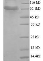 D-glucuronyl C5-epimerase (GLCE), partial, human, recombinant