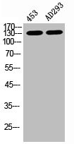 Anti-Phospho-EIF2AK3 (T981)