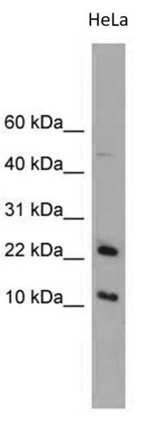 Anti-GM2A
