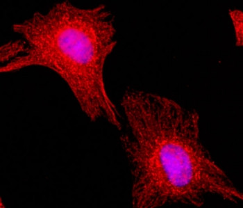 Anti-Alpha Tubulin / TUBA1B, clone RM113