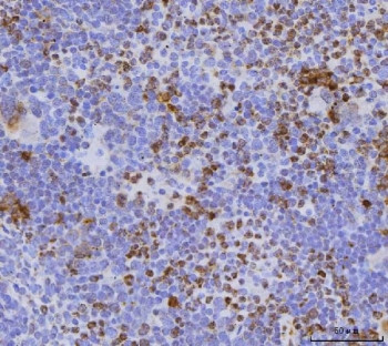 Anti-Cdc25b / M-phase inducer phosphatase 2