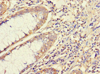 Anti-ATG5