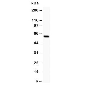 Anti-SSTR1 Somatostatin Receptor 1
