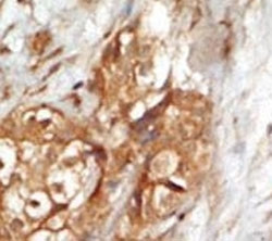 Anti-NIK (NF-kappa-beta-inducing kinase)