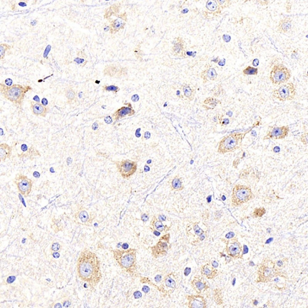 Anti-NTRK2