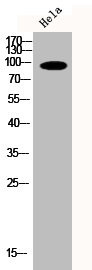 Anti-Phospho-PRKD2 (S876)