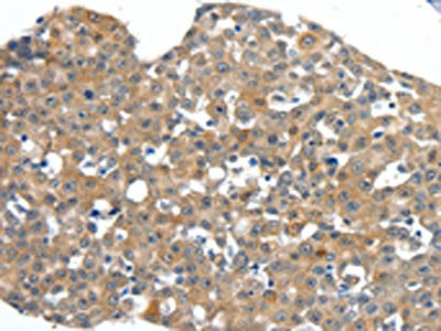 Anti-SCN11A