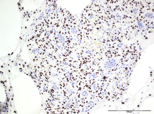 Histone H3.3 Mutation Antibody Panel (G34W, G34R, G34V)
