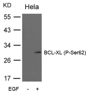 Anti-phospho-BCL-XL (Ser62)