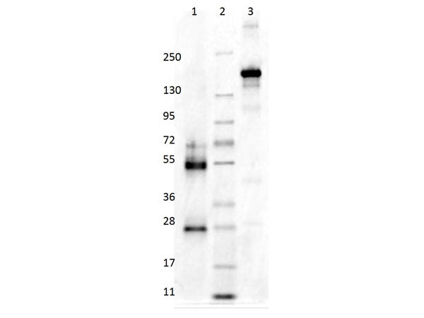 Mouse Gamma Globulin