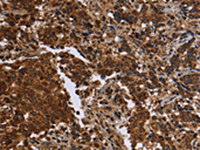 Anti-FMN2