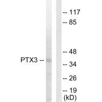 Anti-PTX3