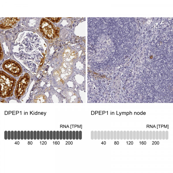 Anti-DPEP1