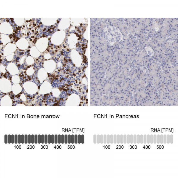 Anti-FCN1