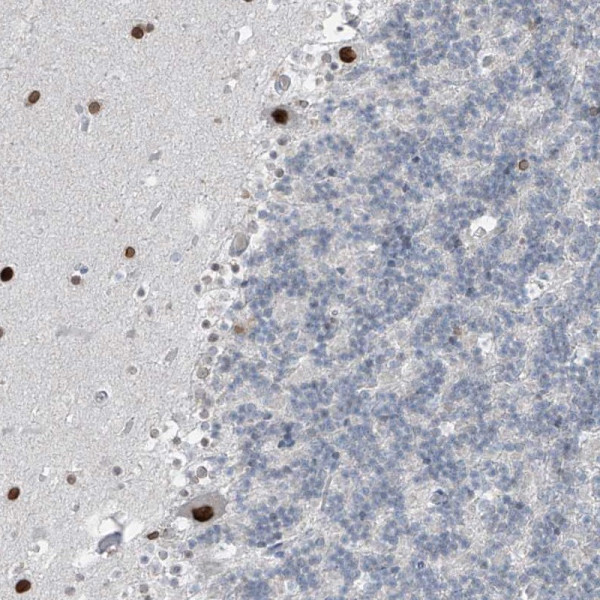 Anti-PRDM6