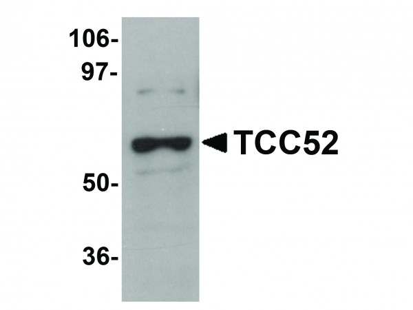 Anti-TCC52