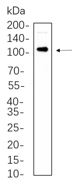 Anti-Recombinant Androgen Receptor, clone 6C6