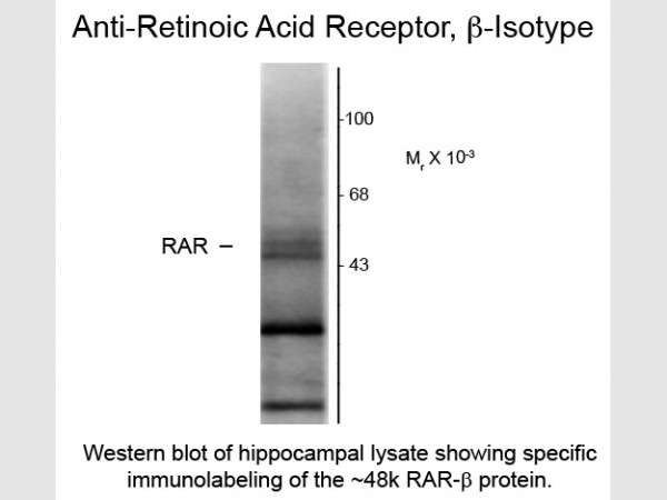 Anti-Retinoic Acid Receptor beta, clone 336