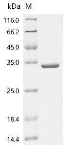 Beta-crystallin B2 (CRYBB2), recombinant Rabbit