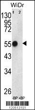 Anti-ATP5B