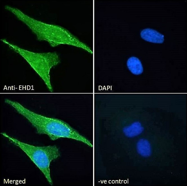 Anti-EHD1