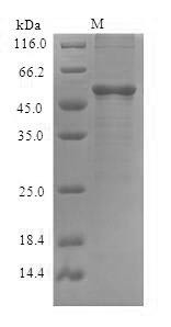 Transcriptional activator DEMETER (DME), partial, Arabidopsis thaliana, recombinant