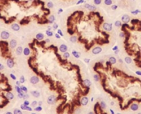 Anti-Cubilin