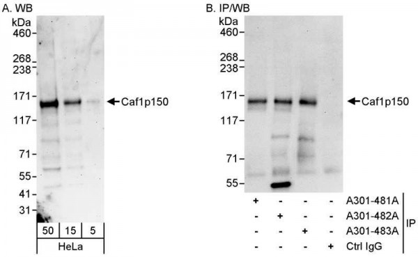 Anti-Caf1p150