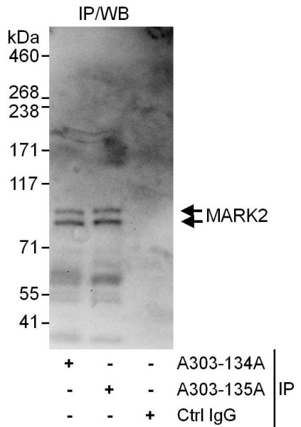 Anti-MARK2
